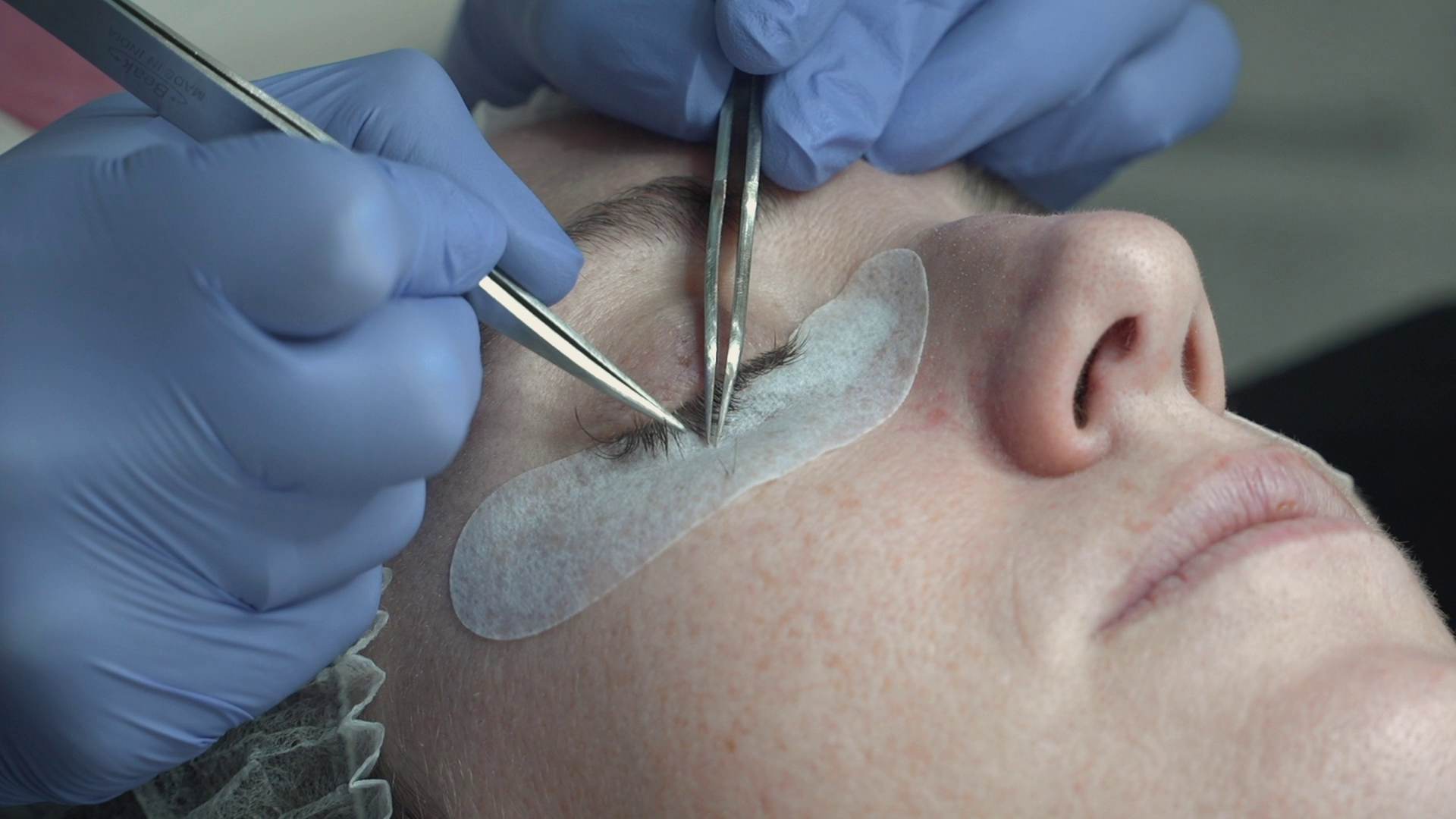 Tratamiento de estética en El Rompido.